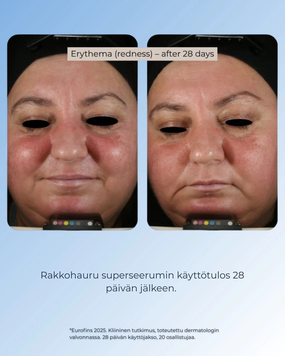 Tuotekuva 7