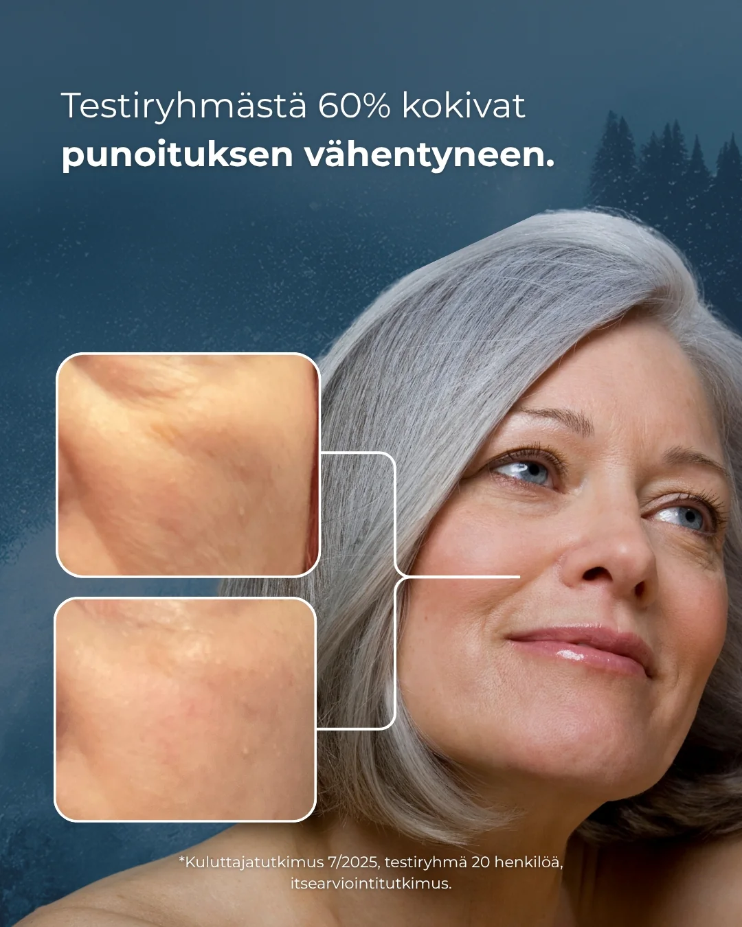 Tuotekuva 6