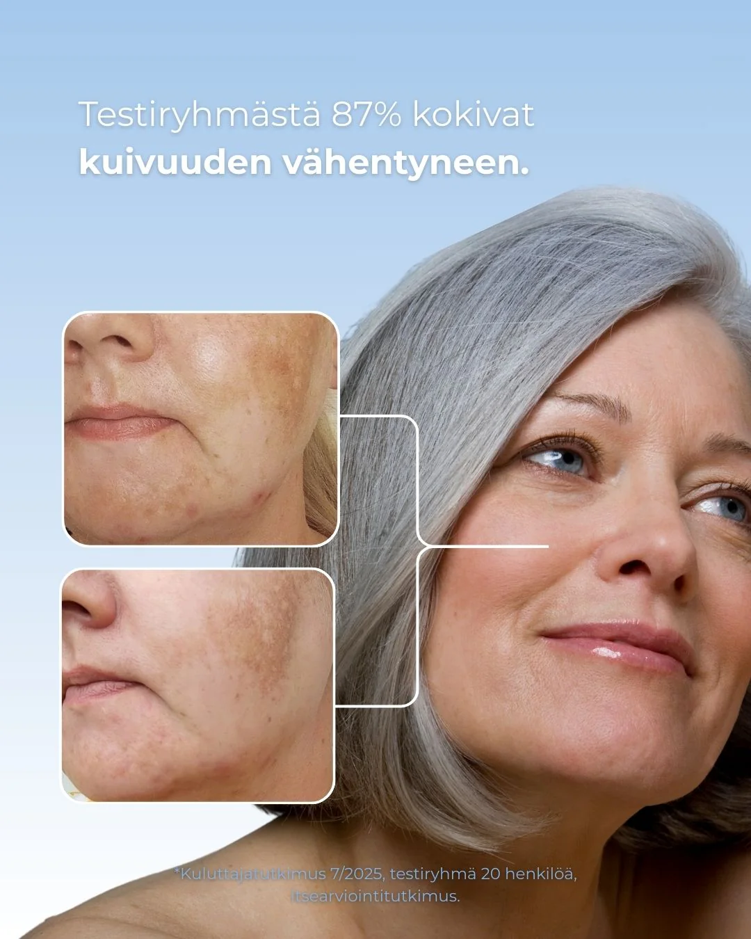 Tuotekuva 3