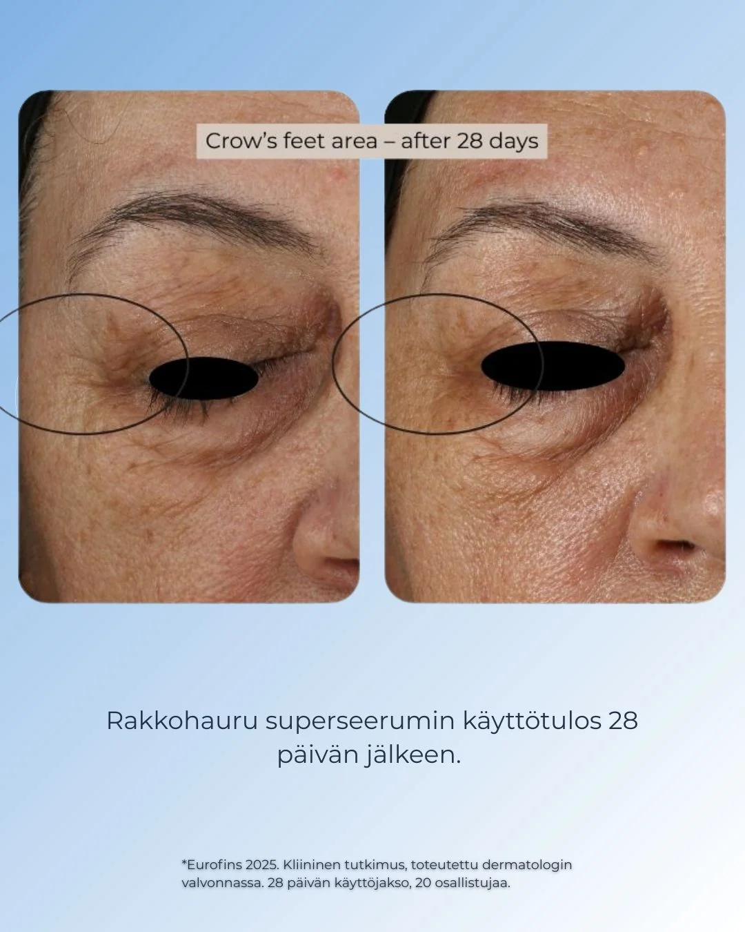Tuotekuva 3