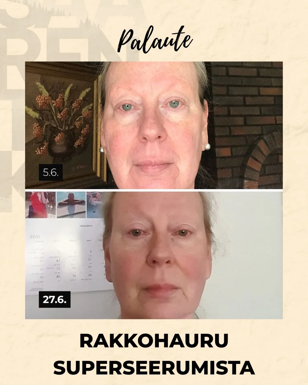 Tuotekuva 20