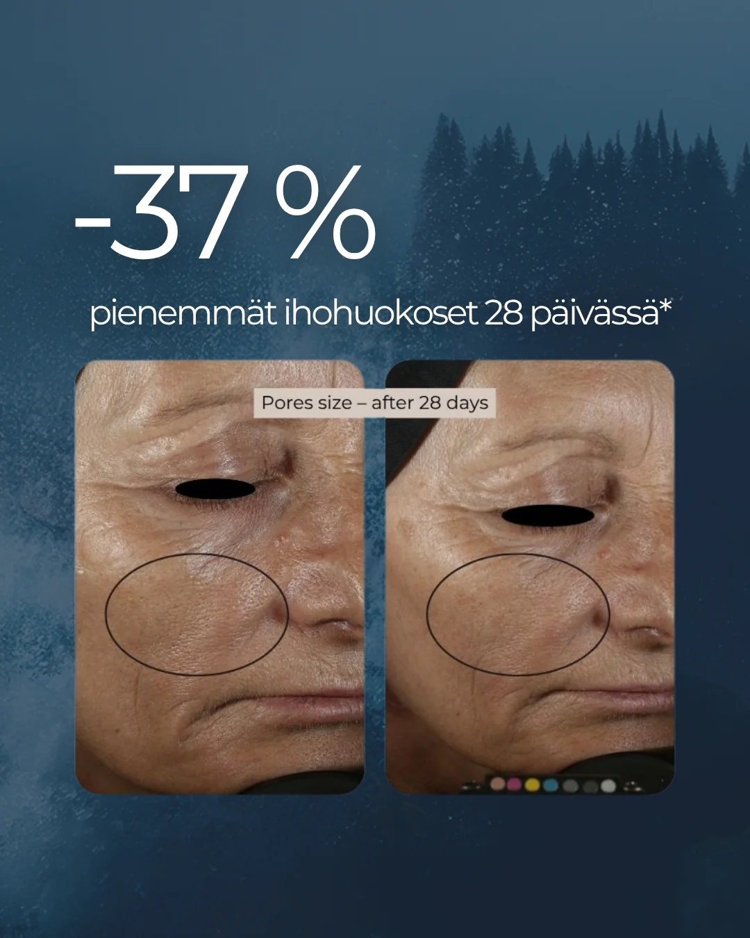 Tuotekuva 6